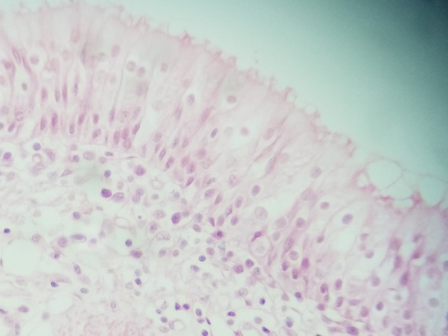Pseudostratified Epithelium Slides - Pseudostratified Epithelium 03 400X
